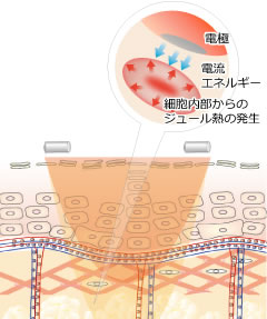 体内熱源が痩身のキーポイント